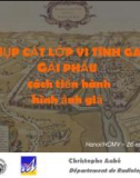 Bài giảng Chụp cắt lớp vi tính gan giải phẫu cách tiến hành hình ảnh giả