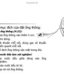 Bài giảng THÔNG TiỂU DẪN LƯU NƯỚC TiỂU RỬA BÀNG QUANG part 6