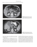 Diseases of the Gallbladder and Bile Ducts - part 3