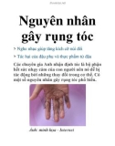 Nguyên nhân gây rụng tóc