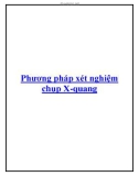 Phương pháp xét nghiệm chụp X-quang.