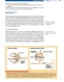 Spinal Disorders: Fundamentals of Diagnosis and Treatment Part 17