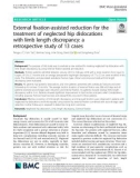 External fixation-assisted reduction for the treatment of neglected hip dislocations with limb length discrepancy: A retrospective study of 13 cases