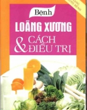 Bệnh loãng xương và cách điều trị: Phần 1