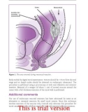 Anal and rectal diseases explained - part 7