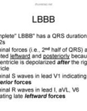 EKG Basics and Interpretation - part 5