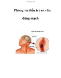 Phòng và điều trị xơ vữa động mạch