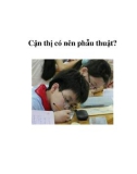 Cận thị có nên phẫu thuật?