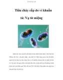 Tiêu chảy cấp do vi khuẩn tả: Vạ từ miệng