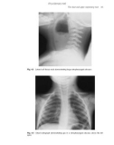 Paediatric Radiography - part 3