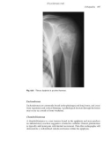 Paediatric Radiography - part 10