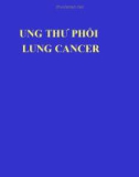 Bài giảng Ung thư phổi lung cancer