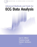 Advanced Methods and Tools for ECG Data Analysis - Part 1