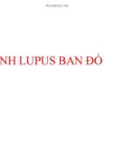 Bài giảng Bệnh Lupus ban đỏ