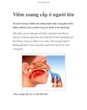 Viêm xoang cấp ở người lớn