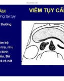 Viêm tụy cấp và mãn tính part 3