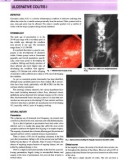 Gastroenterology an illustrated colour text - part 5