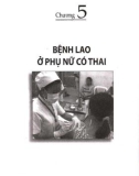 bệnh lao - cách phòng tránh và điều trị: phần 2 - nxb phụ nữ