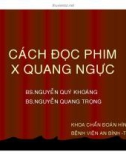 Cách đọc phim x quang ngực