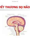 VẾT THƯƠNG SỌ NÃO HỞ