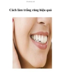 Cách làm trắng răng hiệu quả