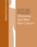 What You Need To Know About - Melanoma and Other Skin Cancers