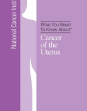 What You Need To Know About - Cancer of the Uterus