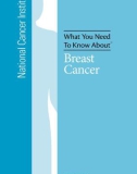 What You Need To Know About™ - Breast Cancer