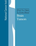 What You Need To Know About - Brain Tumors