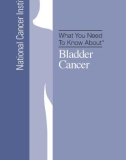 What You Need To Know About - Bladder Cancer