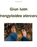 Bài giảng Giun lươn (Strongyloides stercoralis)