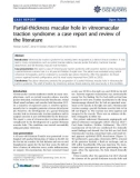 Báo cáo y học: Partial-thickness macular hole in vitreomacular traction syndrome: a case report and review of the literature