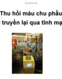 Kỹ thuật tiết kiệm máu