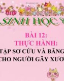 Bài giảng Sinh học 8 bài 12: Thực hành tập sơ cứu và băng bó cho người gãy xương