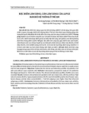 Đặc điểm lâm sàng, cận lâm sàng của lupus ban đỏ hệ thống ở trẻ em