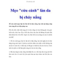 Mẹo cứu cánh làn da bị cháy nắng