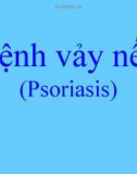 Bài giảng: Bệnh vảy nến