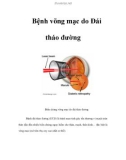 Bệnh võng mạc do Đái tháo đường