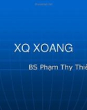 X quang xoang