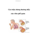 Các triệu chứng thường thấy của viêm phế quản