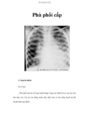 Phù phổi cấp