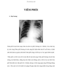 VIÊM PHỔI - ĐẠI CƯƠNG