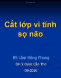 CT sọ não