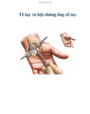 Tê tay và hội chứng ống cổ tay