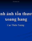 Bài giảng Hình ảnh tổn thương xoang hang - Cao Thiên Tượng