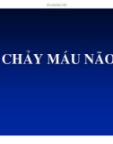 CHẢY MÁU NÃO