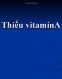 Thiếu vitamin A