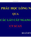 Bài giảng Giải phẫu học lồng ngực qua các lát cắt ngang CT scan - BS. Lê Hữu Linh