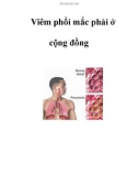 Viêm phổi mắc phải ở cộng đồng