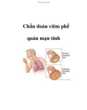 Chẩn đoán viêm phế quản mạn tính